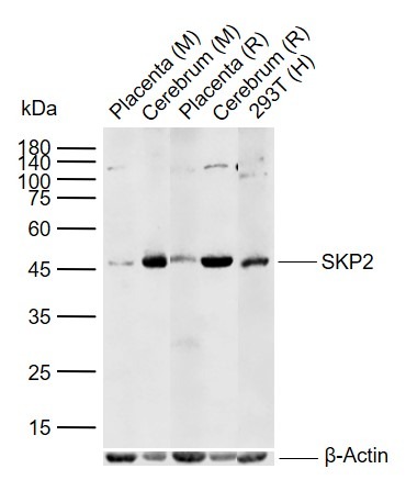 Anti-SKP2 Polyclonal Antibody
