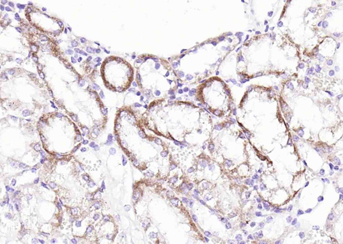 Anti-SLC39A14 Polyclonal Antibody