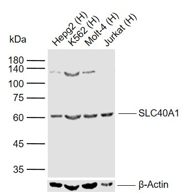 Anti-SLC40A1 Polyclonal Antibody 2