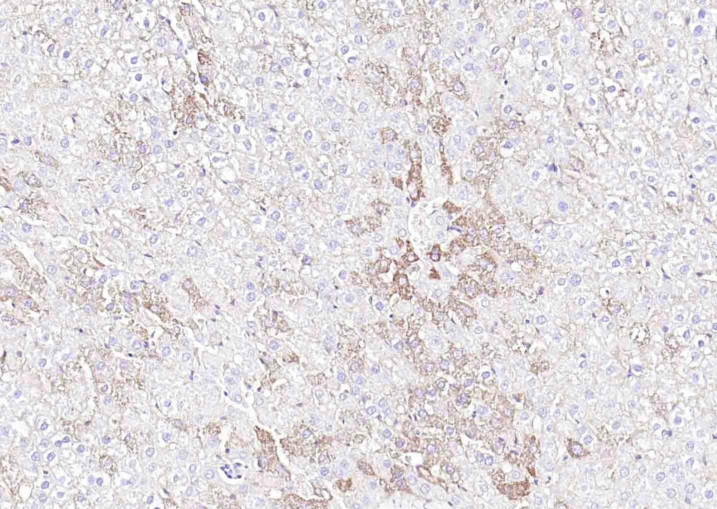 Anti-SLC39A14 Polyclonal Antibody