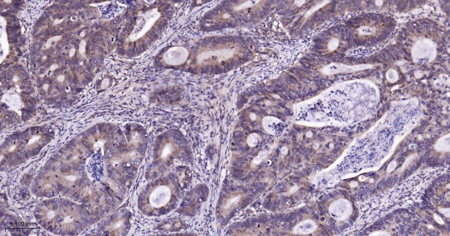 Anti-SIRT3 Polyclonal Antibody 2