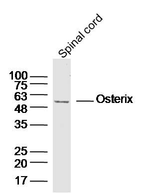 Anti-SP7/Osterix Polyclonal Antibody