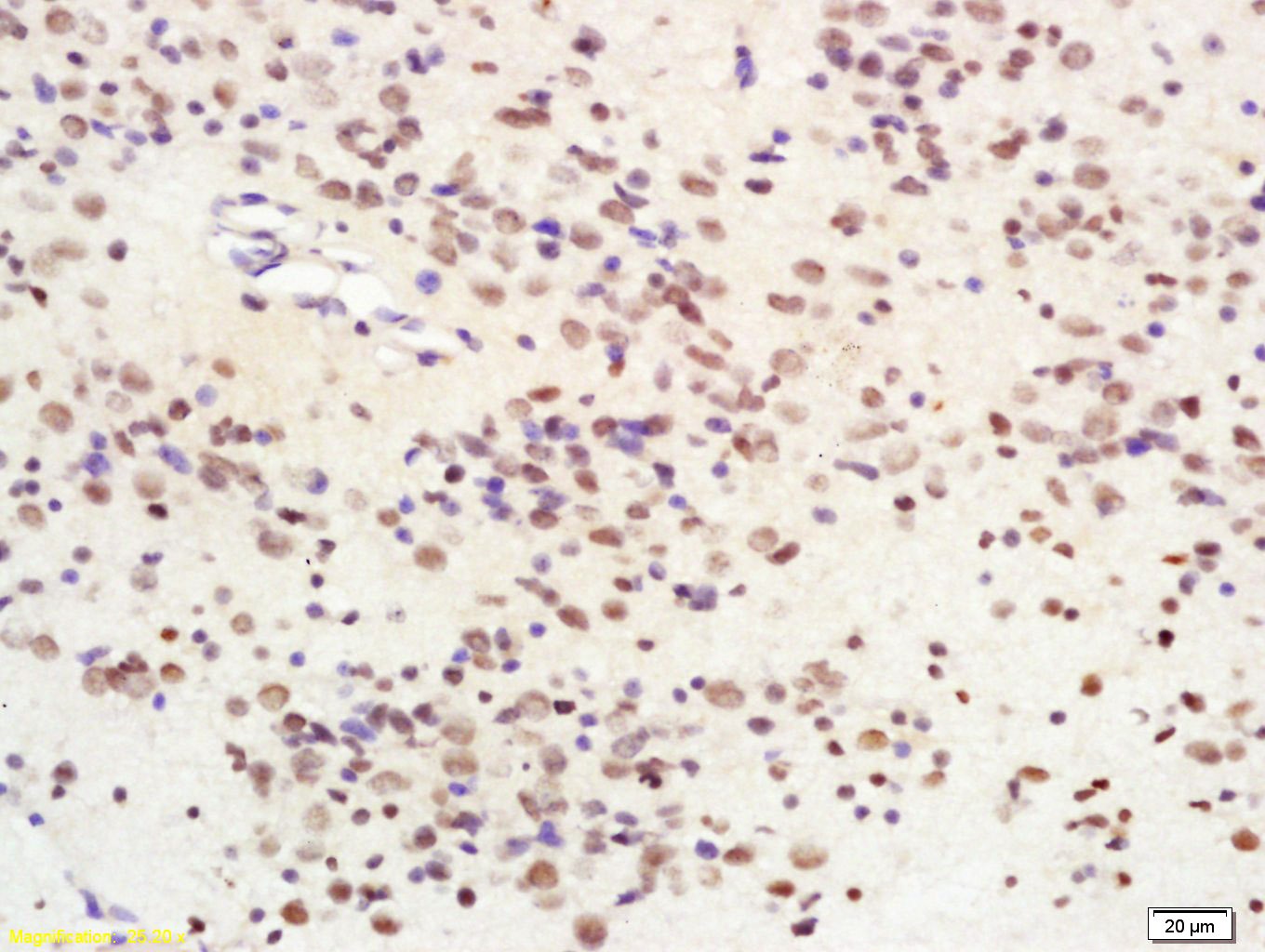 Anti-SIRT1 Polyclonal Antibody 2