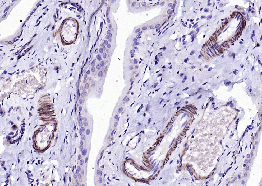 Anti-SM22 Alpha Polyclonal Antibody