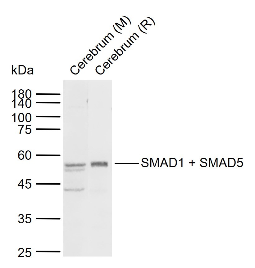 Anti-SMAD1/SMAD5 Polyclonal Antibody