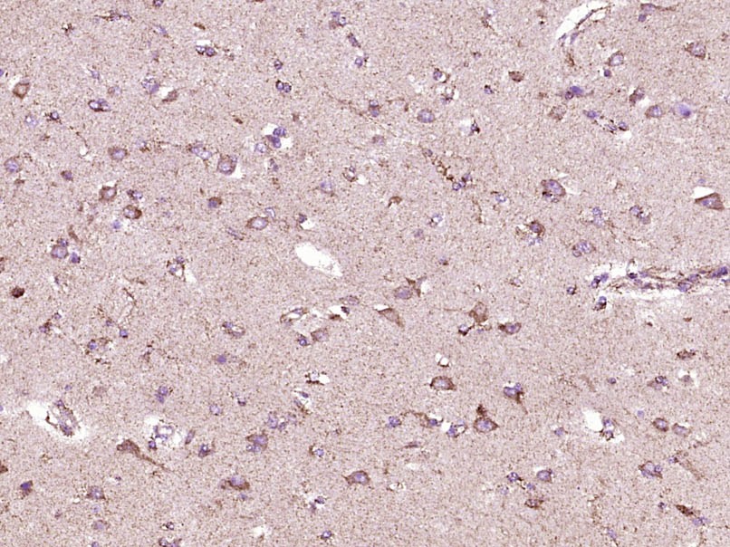 Anti-SMAD1 Polyclonal Antibody