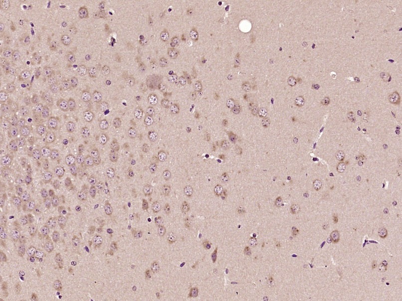 Anti-SMAD1 Polyclonal Antibody