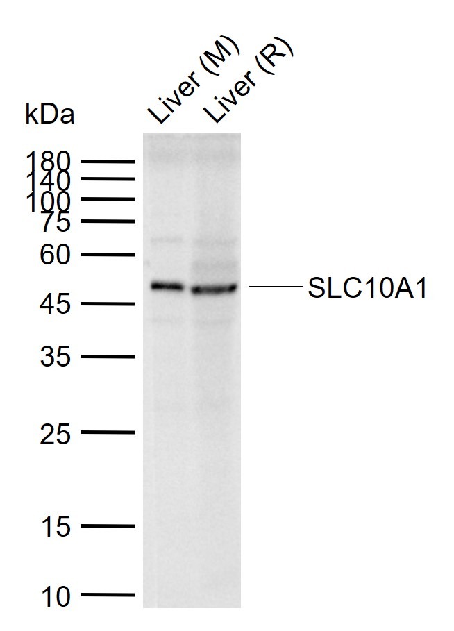 Anti-SLC10A1 Polyclonal Antibody