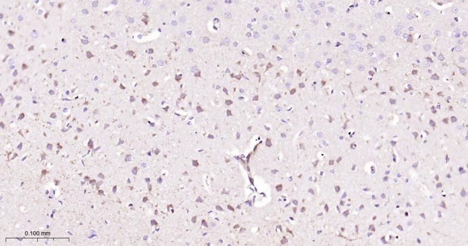 Anti-SMAD2 Antibody (4E515)
