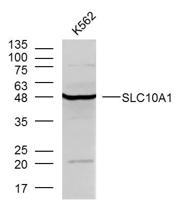 Anti-SLC10A1 Polyclonal Antibody