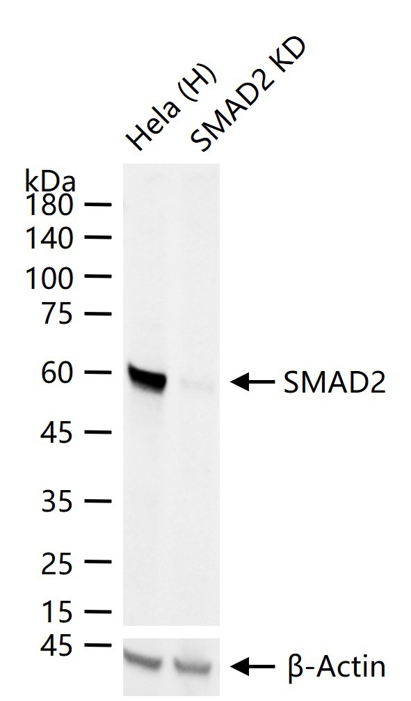 Anti-SMAD2 Antibody (4E515)