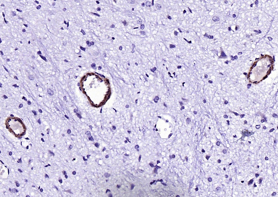 Anti-SM22 Alpha Polyclonal Antibody