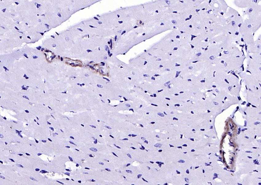 Anti-SM22 Alpha Polyclonal Antibody