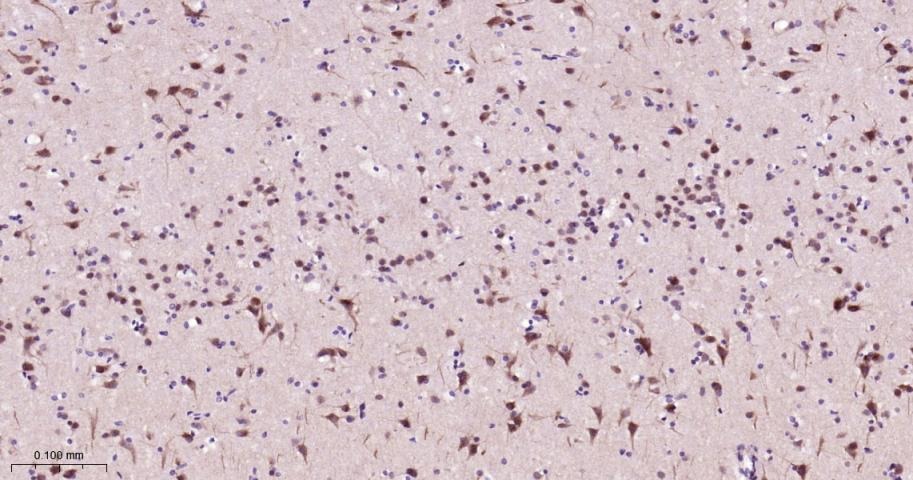 Anti-SMAD2 Antibody (4E515)