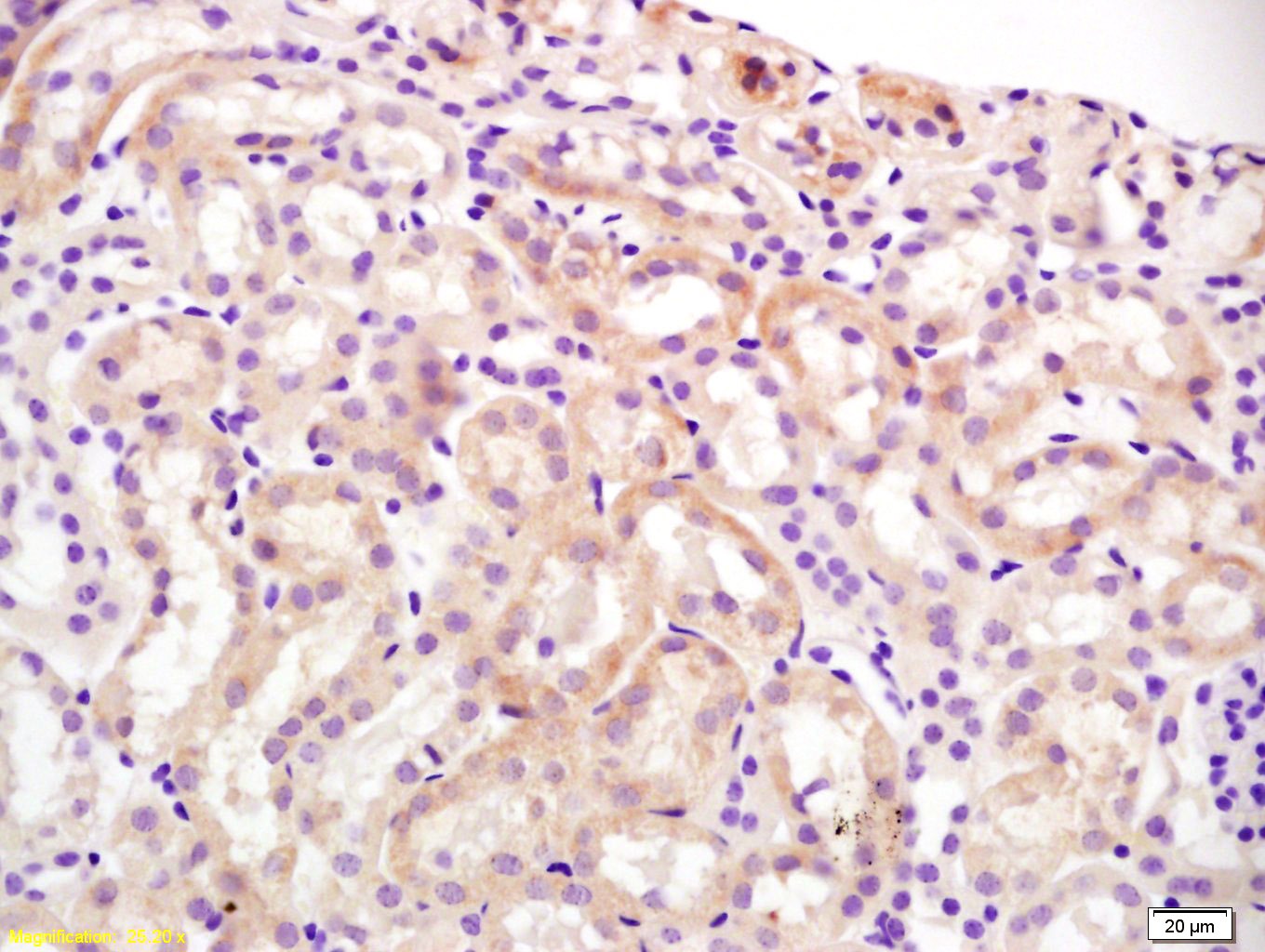 Anti-SLCO1A1 Polyclonal Antibody