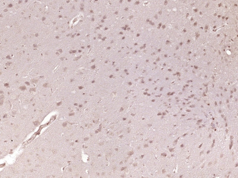 Anti-SMAD1/SMAD5 Polyclonal Antibody