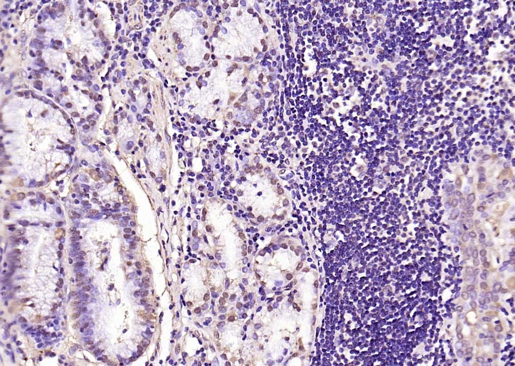Anti-Phospho-Smad3 (Ser423, Ser425) Polyclonal Antibody