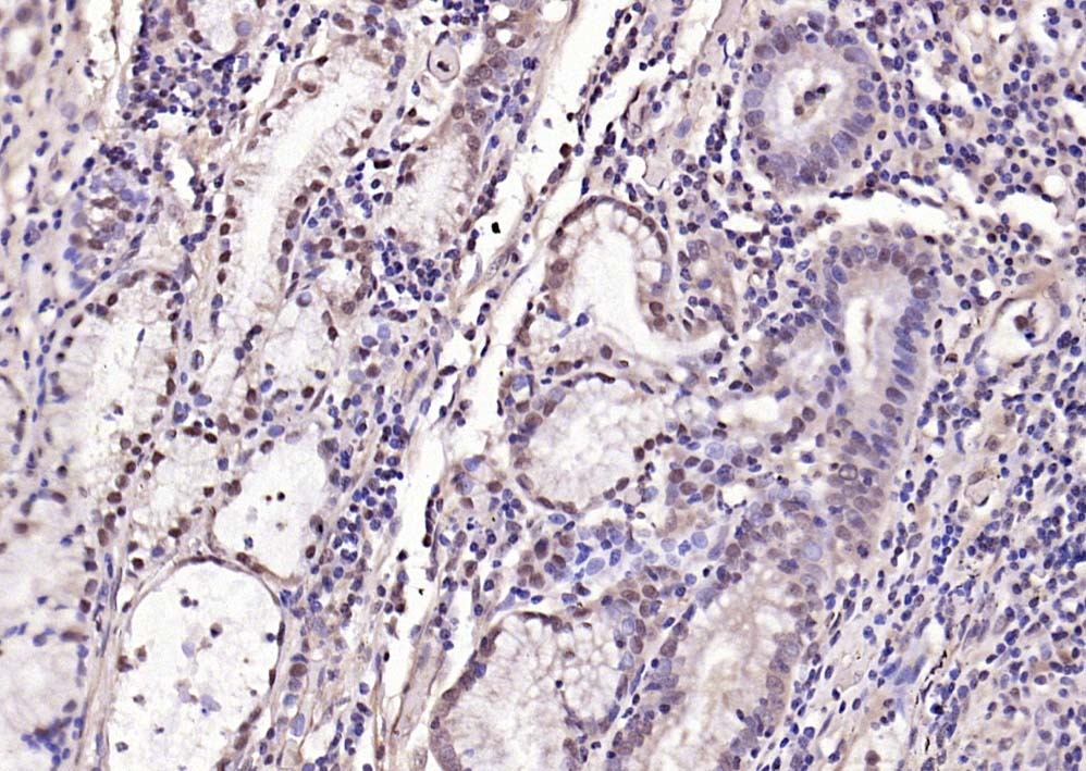Anti-Phospho-Smad3 (Ser204) Polyclonal Antibody