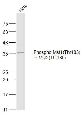 Anti-Phospho-MST1 /2 (Thr183, 180) Polyclonal Antibody