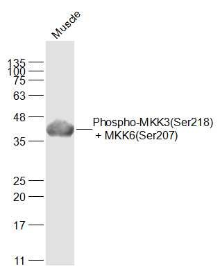 Anti-Phospho-MKK3/6 (Ser218, 207) Polyclonal Antibody