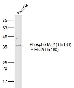 Anti-Phospho-MST1 /2 (Thr183, 180) Polyclonal Antibody