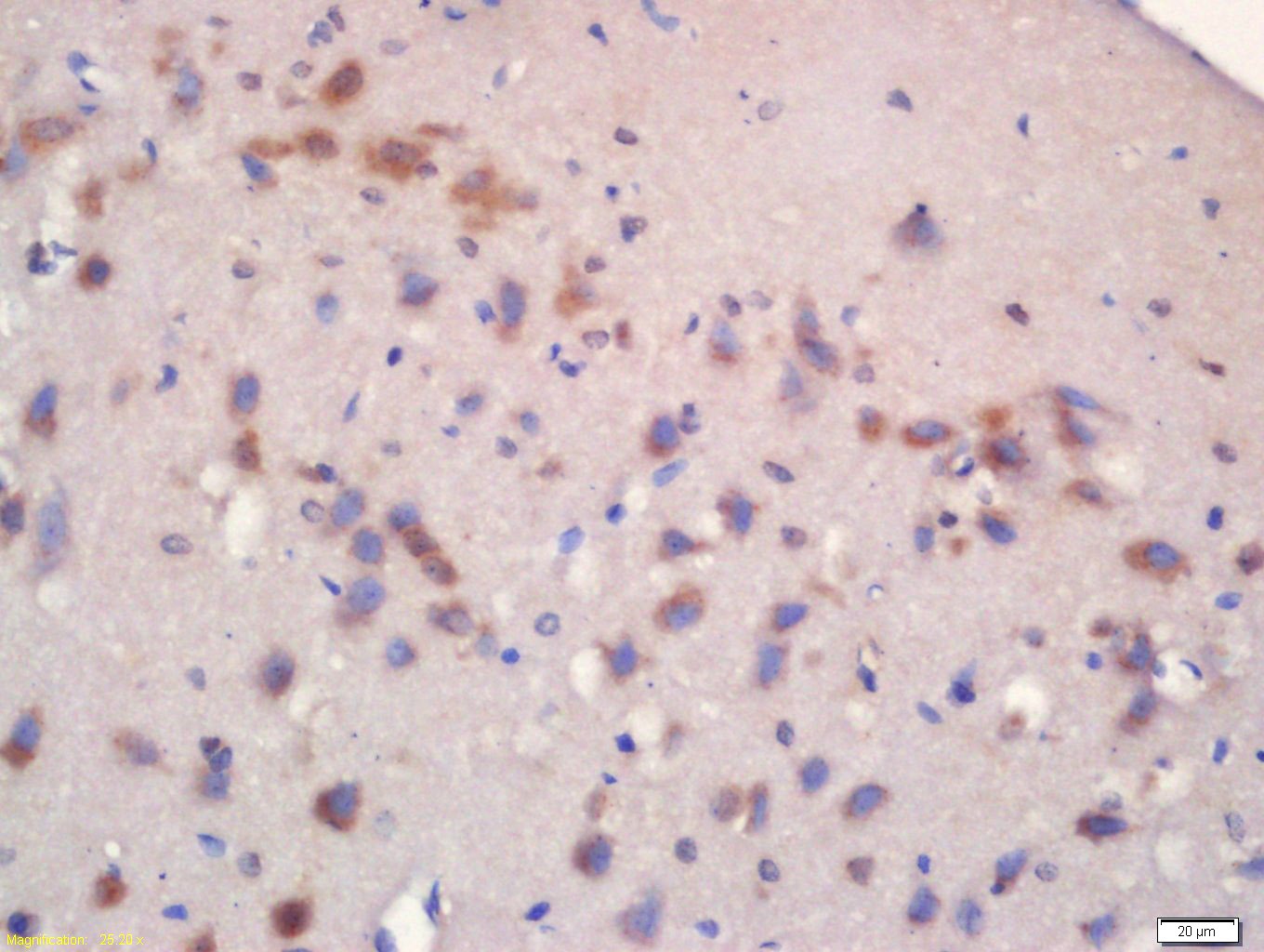 Anti-Phospho-mTOR (Ser2481) Polyclonal Antibody