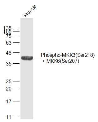 Anti-Phospho-MKK3/6 (Ser218, 207) Polyclonal Antibody