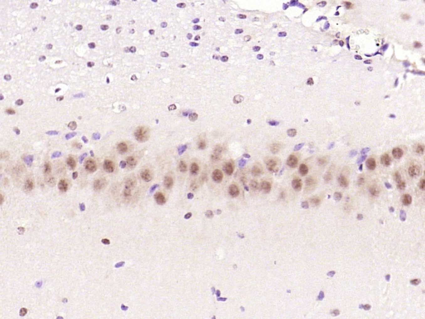 Anti-Phospho-mTOR (Ser2448) Polyclonal Antibody