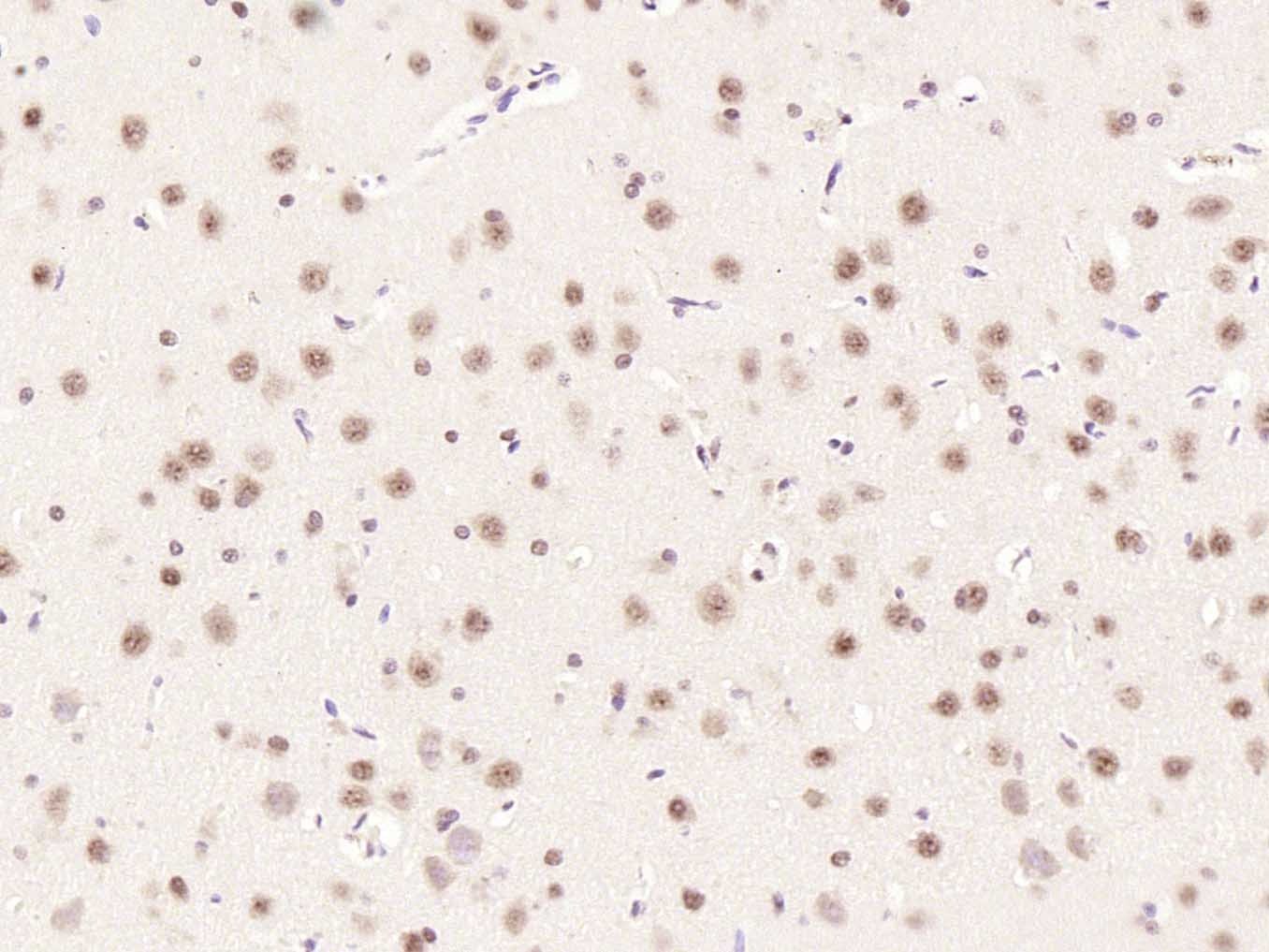 Anti-Phospho-mTOR (Ser2448) Polyclonal Antibody