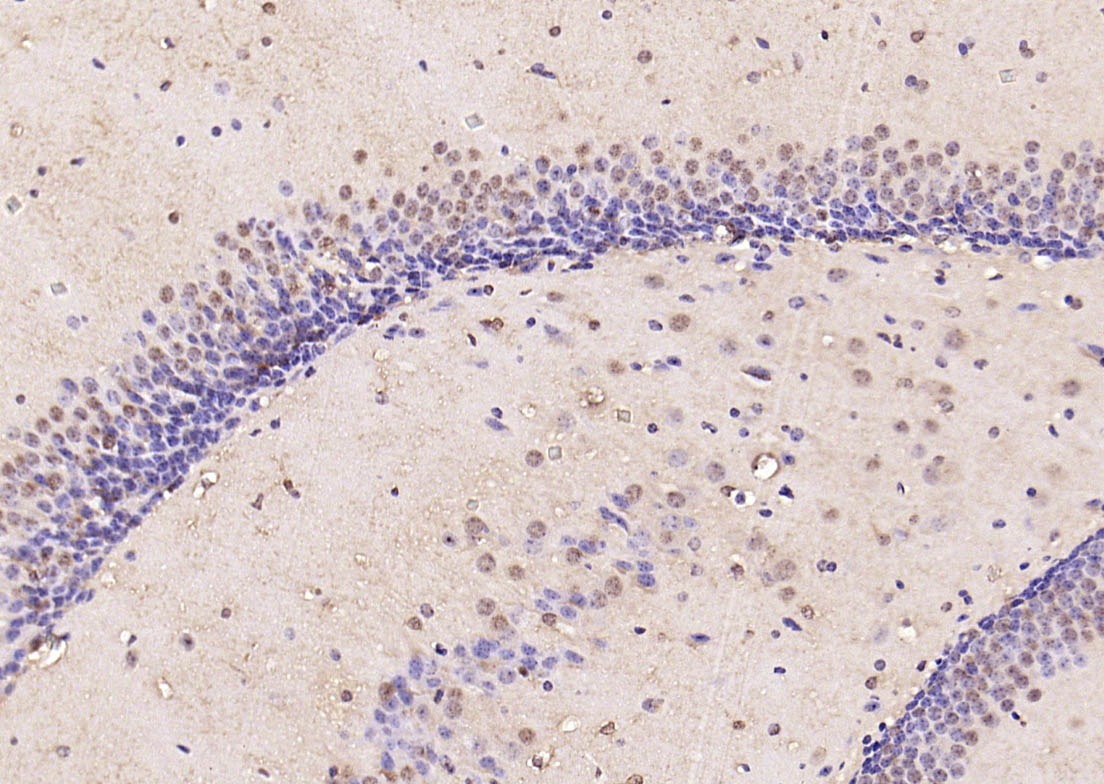 Anti-Phospho-Smad3 (Ser423, Ser425) Polyclonal Antibody