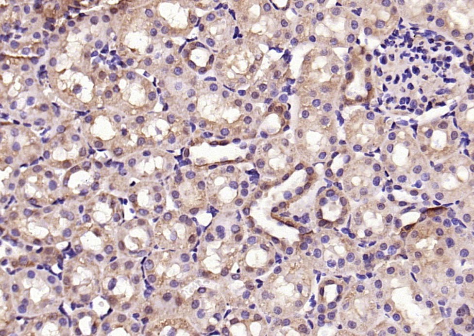 Anti-Phospho-Smad3 (Ser423, Ser425) Polyclonal Antibody