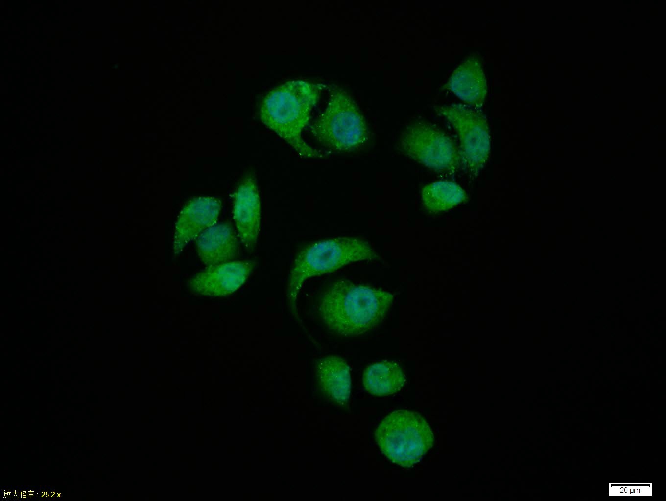 Anti-Phospho-Smad3 (Ser204) Polyclonal Antibody