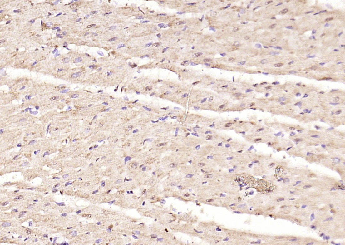 Anti-Phospho-Smad3 (Ser423, Ser425) Polyclonal Antibody