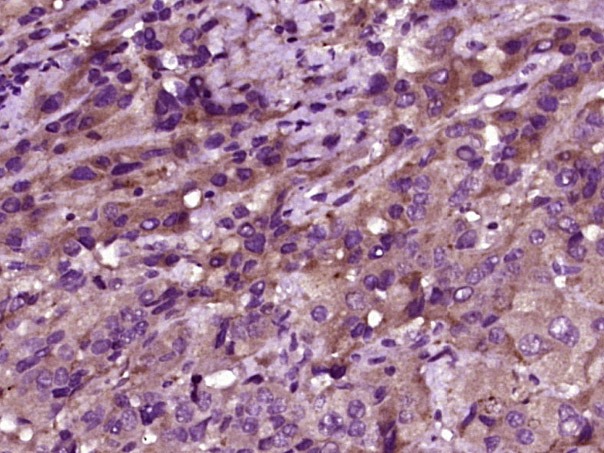 Anti-Phospho-MST1 (Thr183) Polyclonal Antibody