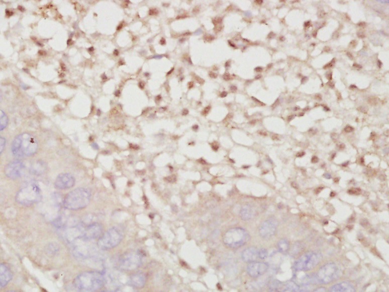 Anti-Phospho-Smad3 (Ser425) Polyclonal Antibody