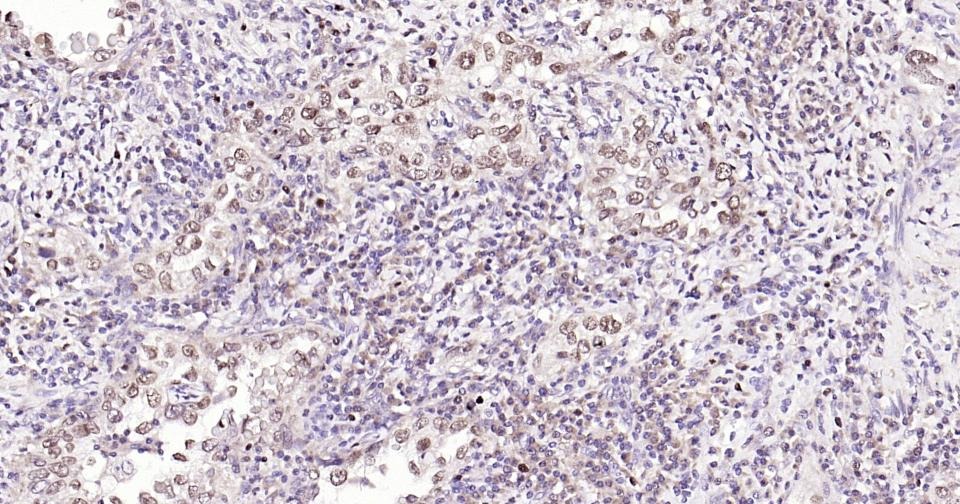 Anti-Phospho-NFE2L2 (Ser40) Antibody (8Z908)