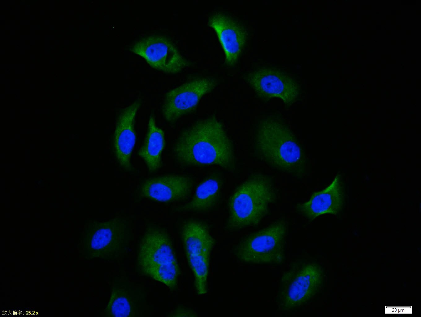 Anti-Phospho-NFE2L2 (Ser40) Polyclonal Antibody