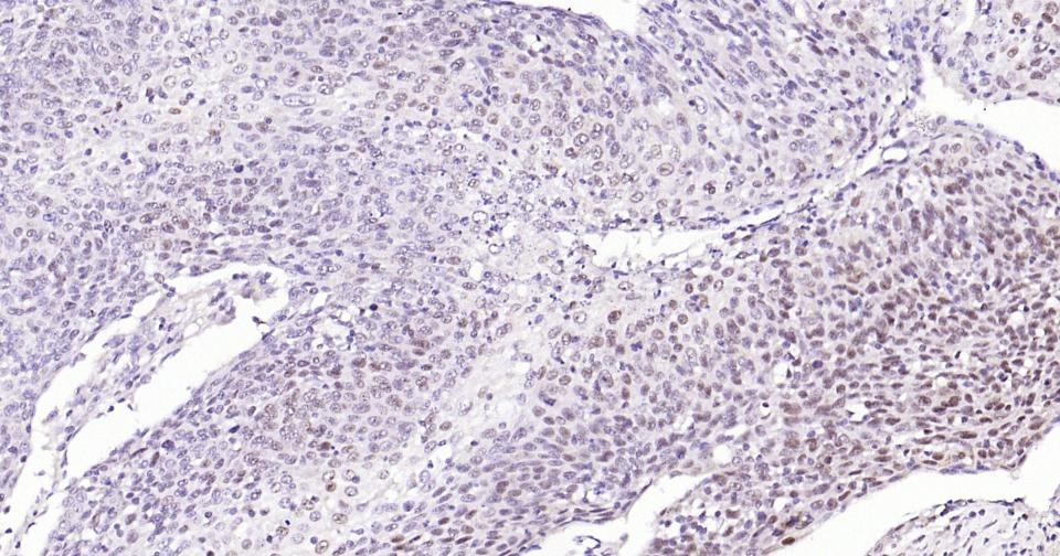 Anti-Phospho-NFE2L2 (Ser40) Antibody (8Z908)