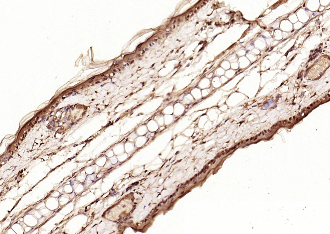 Anti-Phospho-Smad3 (Thr179) Polyclonal Antibody