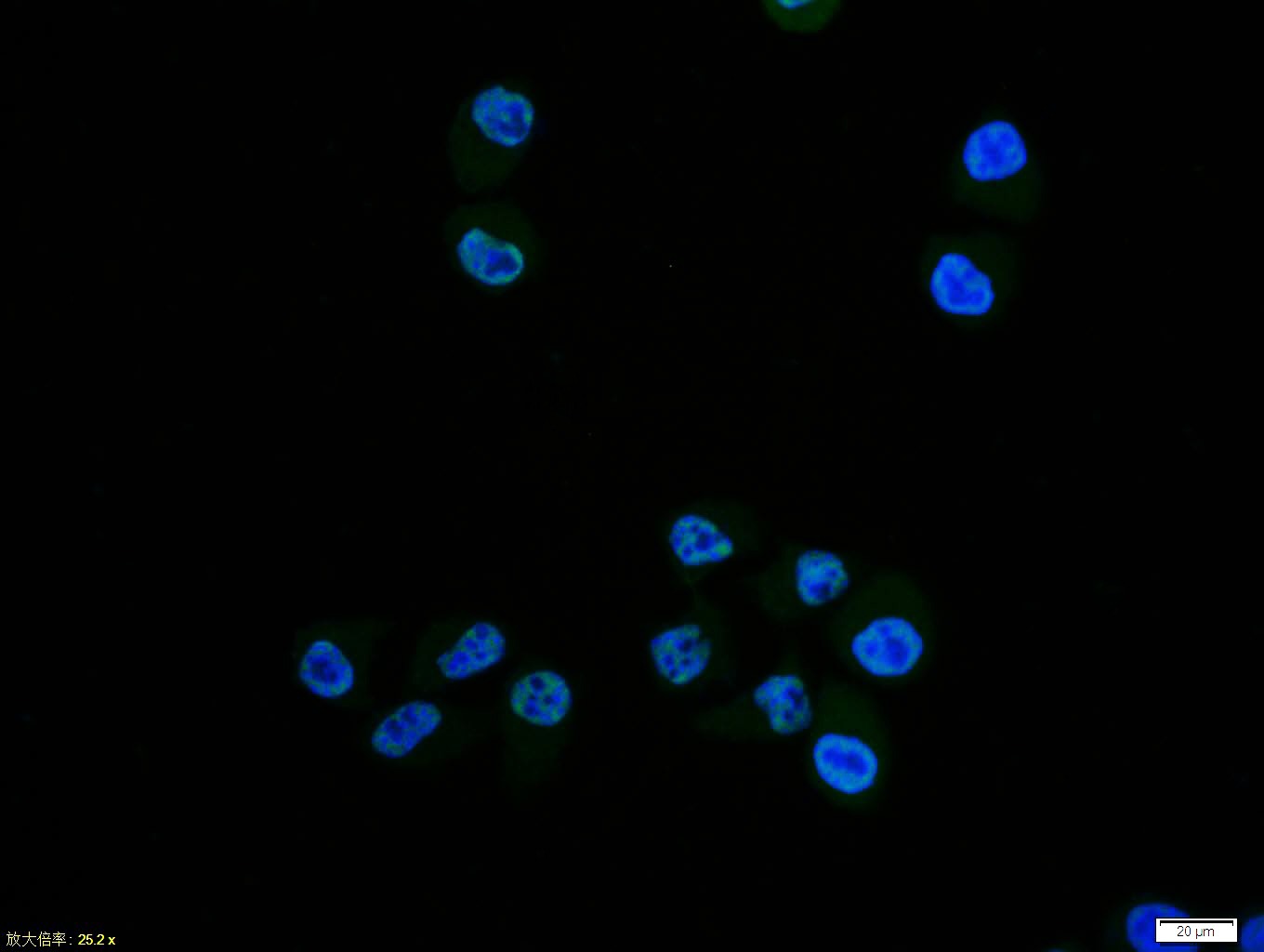 Anti-Phospho-NF-kB p65 (Ser276) Polyclonal Antibody