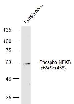 Anti-Phospho-NF-kB p65 (Ser468) Polyclonal Antibody