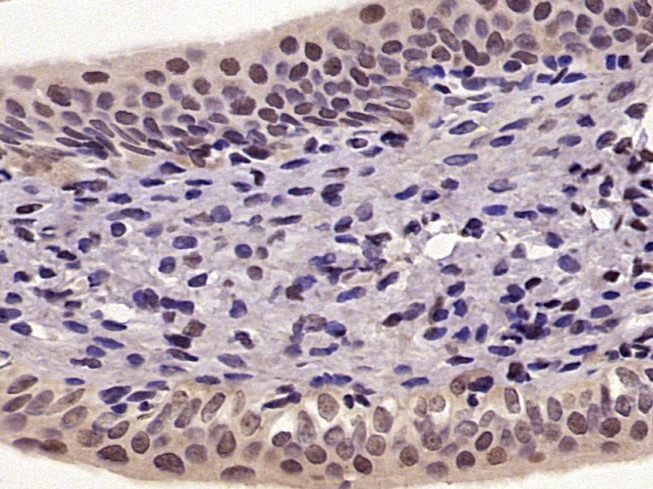 Anti-Phospho-NF-kB p65 (Ser276) Polyclonal Antibody