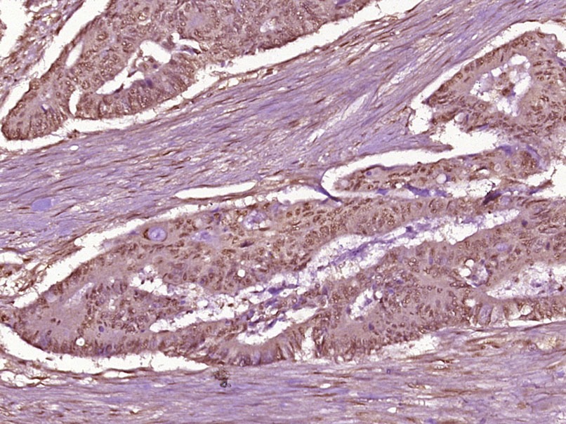 Anti-Phospho-NF-kB p65 (Thr254) Polyclonal Antibody