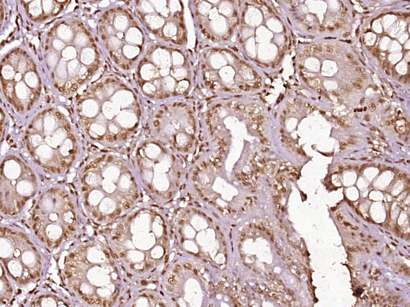 Anti-Phospho-NF-kB p65 (Thr254) Polyclonal Antibody