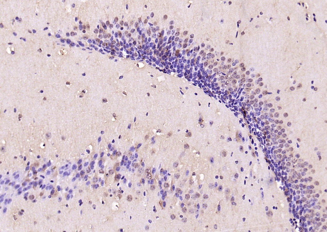 Anti-Phospho-Smad3 (Thr179) Polyclonal Antibody