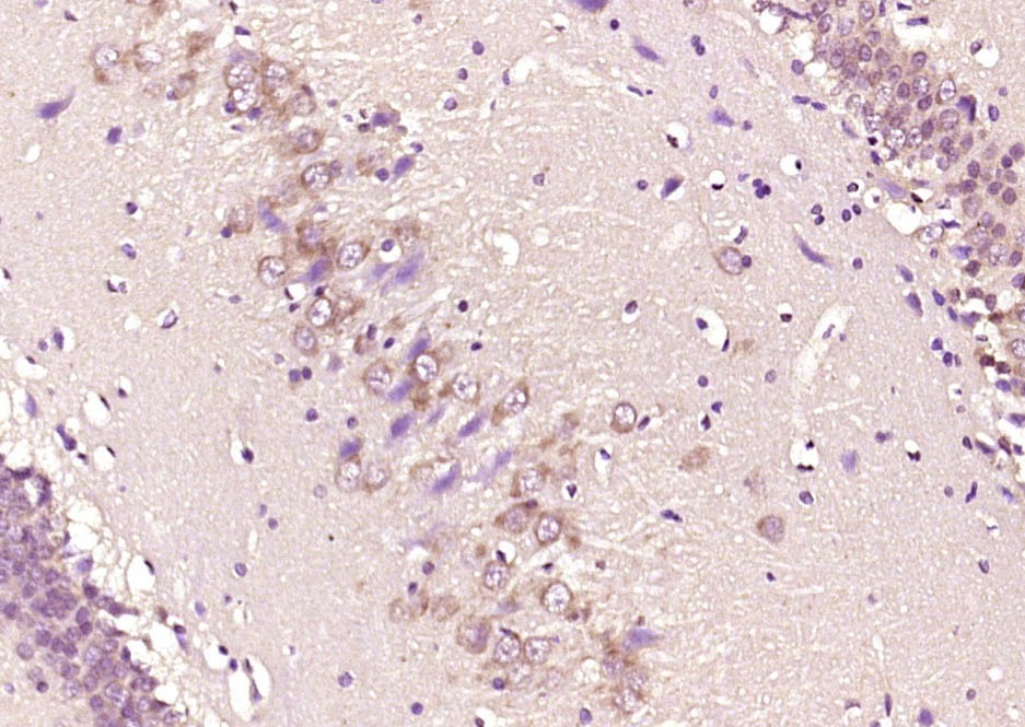 Anti-Phospho-Smad3 (Ser425) Polyclonal Antibody