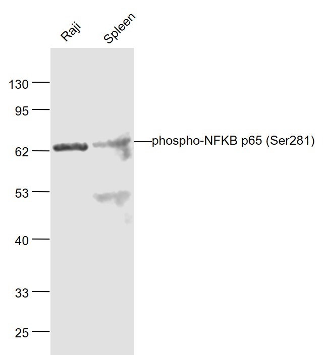 Anti-Phospho-NF-kB p65 (Ser281) Polyclonal Antibody
