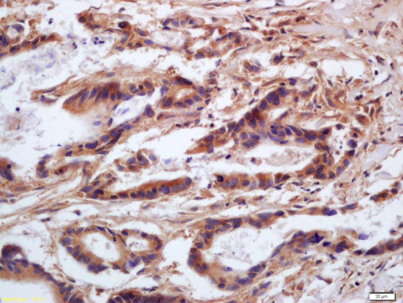 Anti-Phospho-MYL9 (Ser20) Polyclonal Antibody