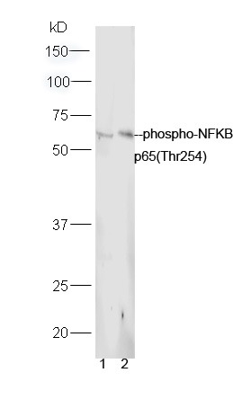 Anti-Phospho-NF-kB p65 (Thr254) Polyclonal Antibody