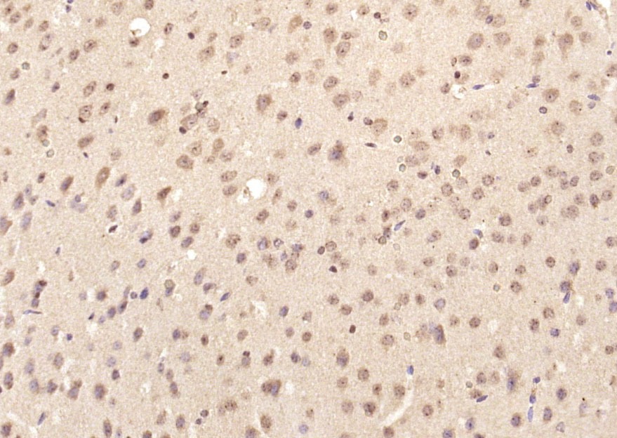 Anti-Phospho-Smad3 (Ser425) Polyclonal Antibody